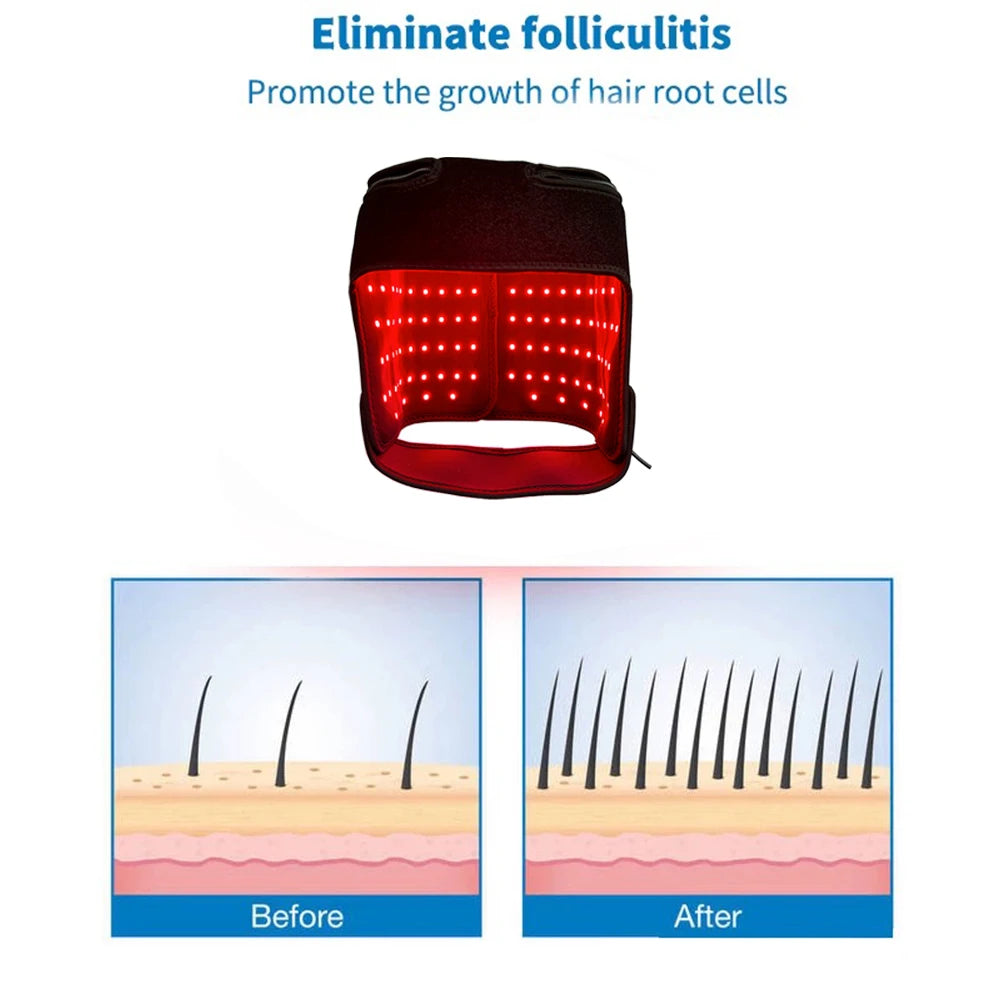 LumiCap180™ - Comprehensive Red Light Cap