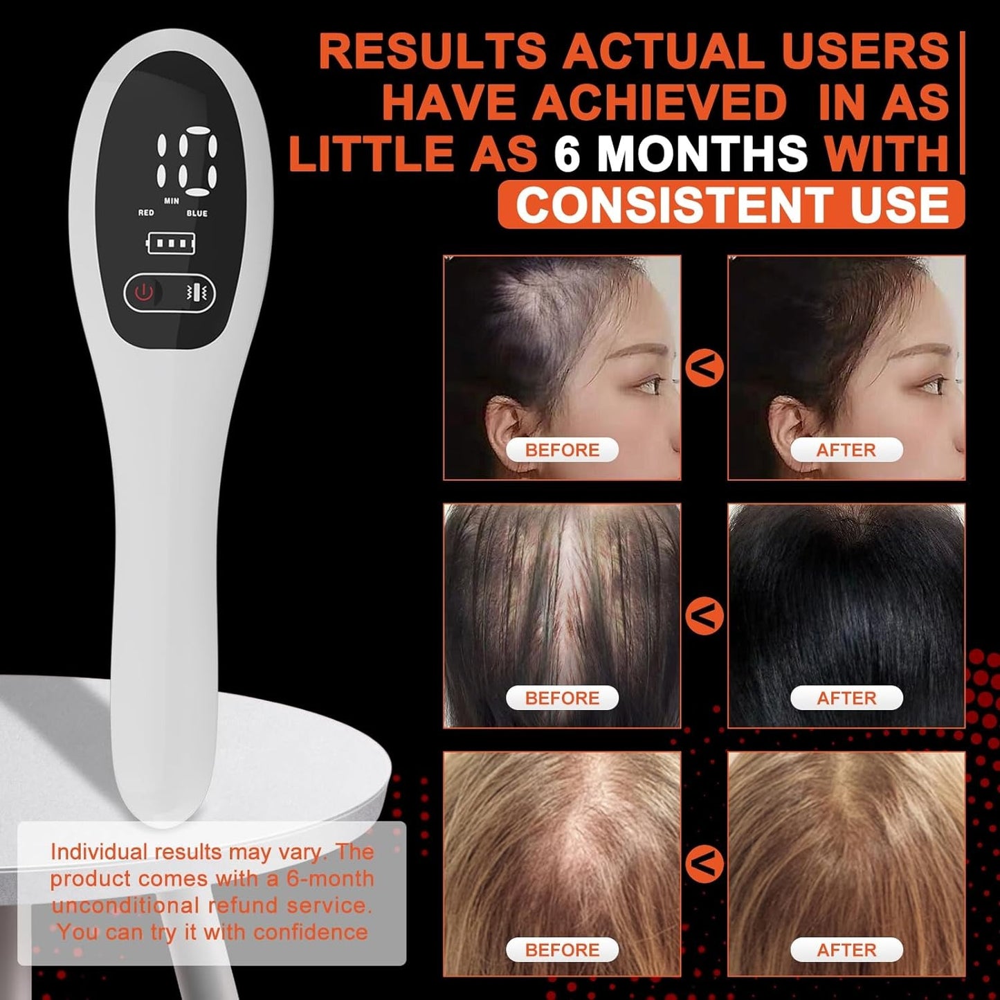 TheraScalp™ - Amazing Red Light Therapy Comb