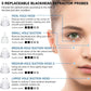 PoreSonic™ Electric Acne Black Head Remover