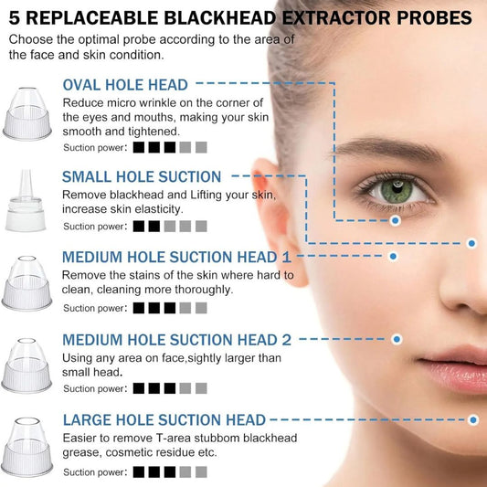 PoreSonic™ Electric Acne Black Head Remover